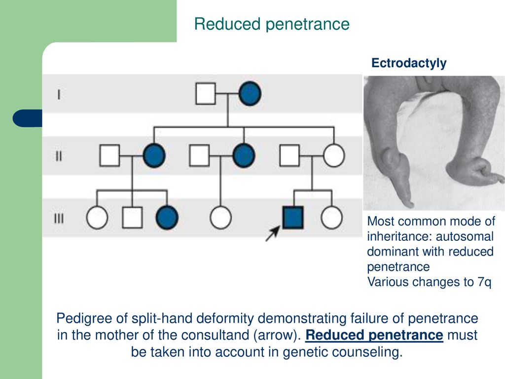 Patterns Of Single Gene Inheritance Chapter Genetics In Medicine